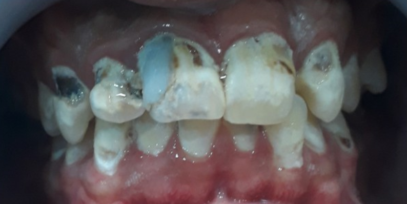 before